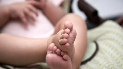تصویری از تولد یک نوزاد عجیب الخلقه و وحشتناک؛ اگر دلش را ندارید نبینید/ عکس