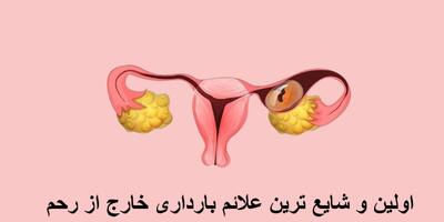 اولین و شایع ترین علائم بارداری خارج از رحم؛ از کجا بفهمیم بارداری خارج از رحم است؟