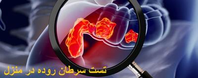 تست سرطان روده در منزل چگونه است؟ تشخیص سرطان روده با یک تست ساده و ارزان