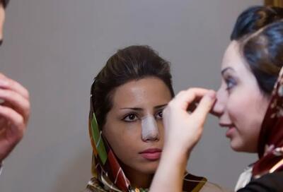 عکس؛ بینی‌هایی که زندگی را تغییر می‌دهند؛ روایت زنان ایرانی از قدرت زیبایی چهره