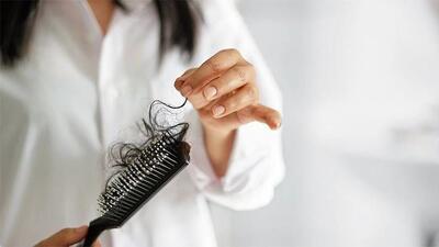 ۲۰ خوراکی پیشنهادی برای جلوگیری از ریزش مو