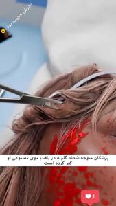 فیلم معجزه موهای مصنوعی / زن جوان گلوله‌خورده از مرگ گریخت