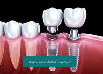 لیست 10 تایی بهترین متخصص ایمپلنت دندان