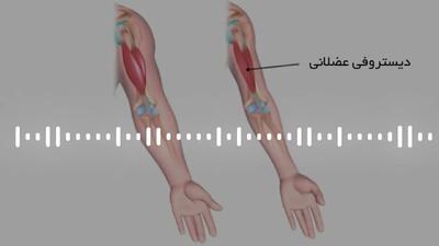 دیستروفی عضلانی چیست ؟ + فیلم
