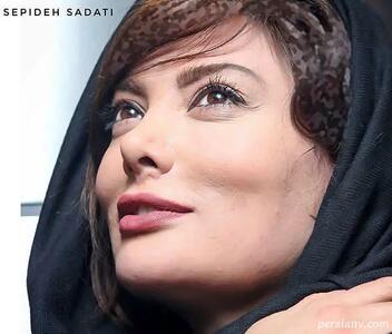 آیا این همان نگار است؟ راز تغییر چهره‌ی ستاره سینما