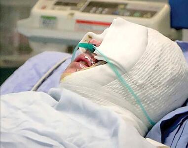 زن خشمگین، شوهر خائن را در خیابان سوزاند