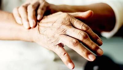 ایرانیان ۴۰ درصد بیشتر به پارکینسون مبتلا می‌شوند