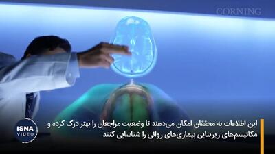 شناخت دقیق روان پنهان بیماران با هوش مصنوعی