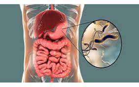 علائم معده میکروبی و زخم معده