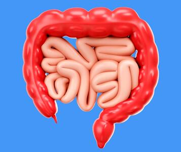 با این خوراکی از ابتلا به سرطان روده بزرگ پیشگیری کنید