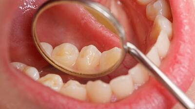 میگنا - دهان؛ آیینه‌ای از وضعیت سلامت بدن