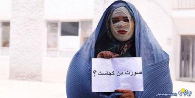 سناریوی دروغین اسیدپاشی برای رهایی از دست زن همسایه | روزنو