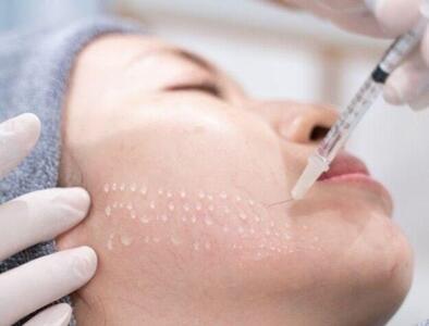 در هر جلسه مزوتراپی چند سی سی تزریق میشود؟
