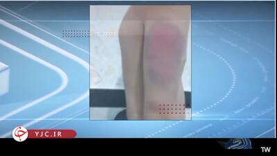 گزارش صداوسیما از تنبیه بی‌رحمانه بدنی ۱۳ دانش آموز در سنندج