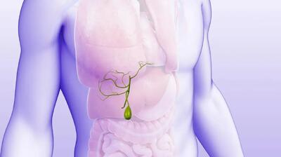 علائم پنهان سنگ کیسه صفرا؛ درد کیسه صفرا دقیقا کجای شکم است؟