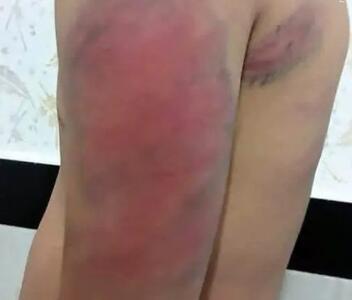 تشکیل پرونده قضائی برای ضرب و جرح دانش‌آموزان کردستانی