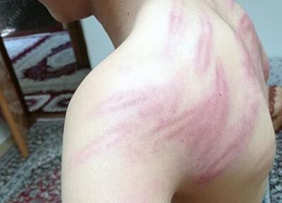 احضار متهم ضرب‌وشتم و شکنجه دانش‌آموزان به دادسرا | رویداد24