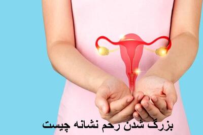 بزرگ شدن رحم نشانه چیست و چه خطری دارد؟ درمان آن در طب سنتی