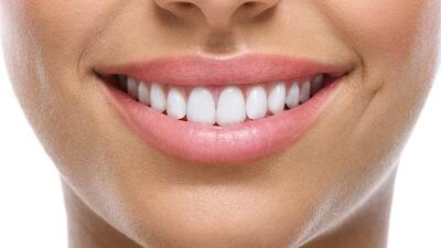 کامپوزیت بهتر است یا لمینت؟