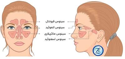 فیلم: سینوس بینی چیست؟