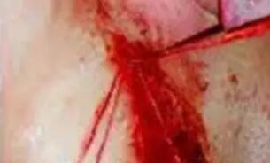مرد عجیب الخلقه هر روزیک تکه از گوشت بدنش را می خورد/ عکس دلخراش