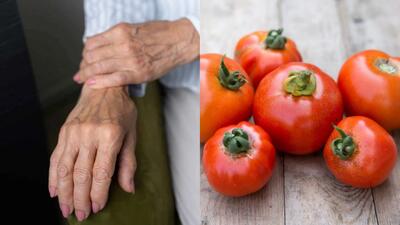 تاثیر گوجه فرنگی بر آرتروز و فواید آن برای سلامت مفاصل
