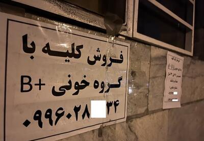 خبر تکان‌دهنده از فروش کلیه ۷۰ میلیاردی در تهران!