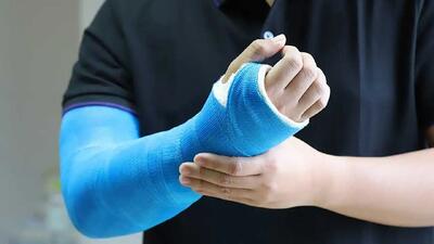 شکستگی استخوان چه علائمی دارد؟ + فیلم