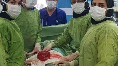 عمل جراحی موفق تومور پیشرفته شکمی توسط تیم پیشکسوت دانشگاه علوم پزشکی سمنان