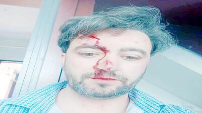 ضرب‌و‌شتم دانشجوی علوم سیاسی دانشگاه تهران در سفارت افغانستان در تهران