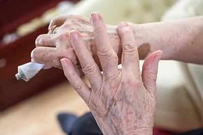 پیری سریع مغز می‌تواند باعث این بیماری روانی خطرناک شود