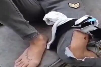 شلیک پلیس به «ممد طراح» شرورِ معروف تهران که دیروز روده های یک شرور دیگر را بیرون ریخته بود