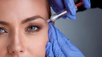 بوتاکس ابرو / روشی کم تهاجمی برای لیفت و جوانسازی ابروها