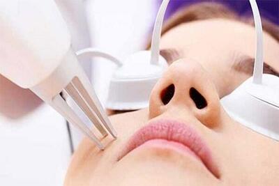 چرا دستگاه‌های تجهیز گستر لیزر مادیار انتخاب اول متخصصان پوست و مو هستند؟