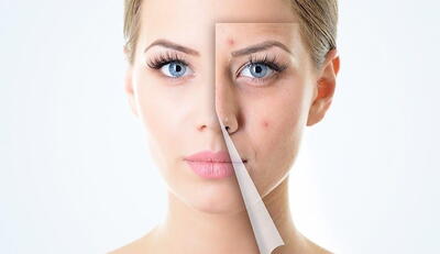 نکاتی ساده برای داشتن پوستی صاف و یکدست