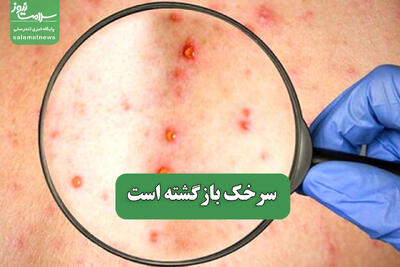 سرخک بازگشته است