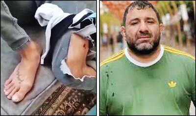 هانی‌کرده و ممدطراح هم با شلیک پلیس زمین‌گیر شدند