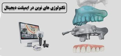 هزینه ایمپلنت دیجیتال (لیست قیمت) کلینیک رابین