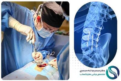 بهترین روش درمان دیسک کمر کدام است؟ از علائم تا درمان‌های ممنوعه