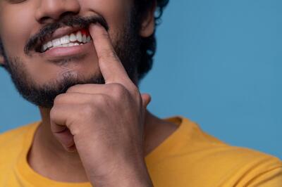 ۷ روش خانگی برای پاک کردن لکه های قهوه ای روی دندان | چگونه دندان هایمان را مثل برف سفید کنیم ؟