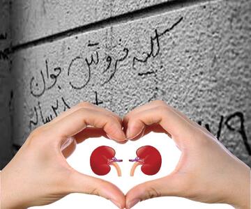 قیمت فروش کلیه یک میلیارد تومان شد!