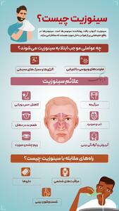 سینوزیت چیست؟