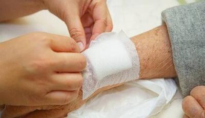 ابتکار دانشمندان ایرانی در ابداع یک پانسمان نوین