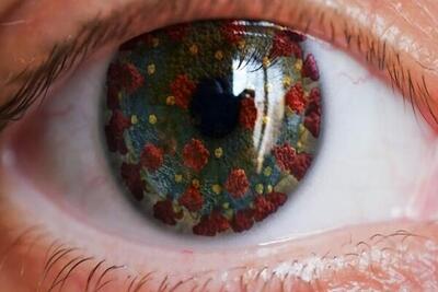 علایم کرونای چشمی را جدی بگیرید