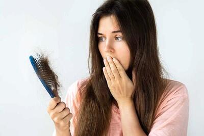 باورهای نادرست درباره ریزش مو؛ کدام گزینه درمانی بهتر است؟