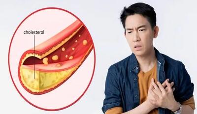 چگونه خشکبار به مدیریت کلسترول کمک میکند؟