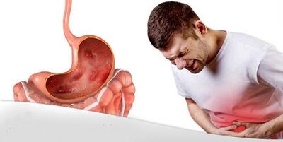 چرا زخم معده در ایرانی‌ها شایع است؟/ داروهای مسکن چه نقشی دارند؟