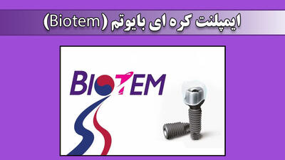 مقایسه و بررسی کامل ایمپلنت های دندانی: بایوتم، آیرس و اشترومن
