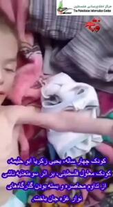 کودک معلول فلسطینی، بر اثر سوءتغذیه ناشی از تداوم محاصره جان باخت + فیلم