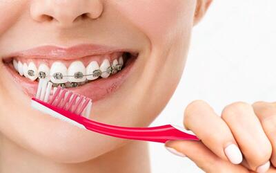 چگونه بعد از ارتودنسی، لبخندتان را حفظ کنید